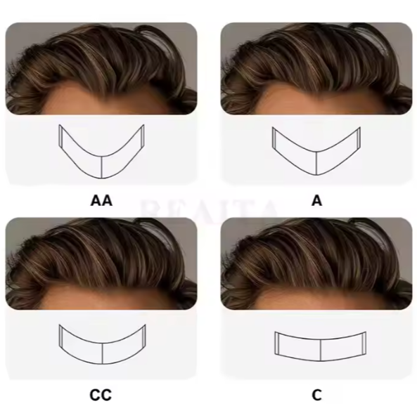 Hair System Fine Welded Mono With Reinforced Perimeter And Front Micro Skin With V Loop