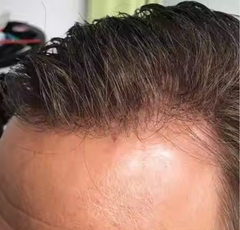 Human Hair Toupee Hair Replacement System